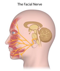 facial nerve facial pain headache