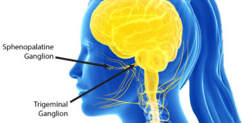 headache, migraine, cluster headache, facial pain, atypical facial pain, triptan, topamax, botox